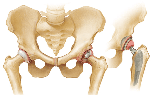 hip joints