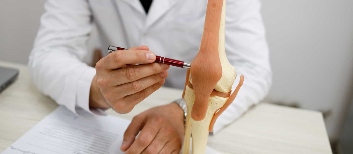 joint replacement orthopedic-doctor
